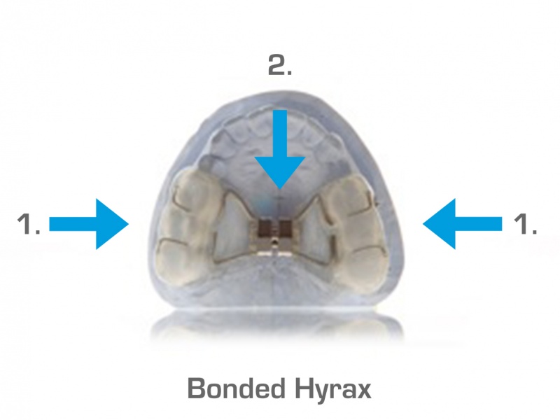 BondedHyrax.jpg