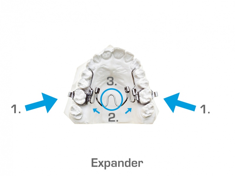 Expander1.JPG